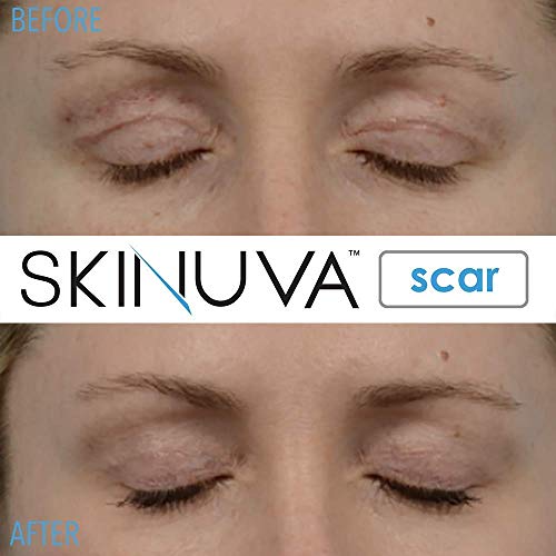 Skinuva® Crema para cicatrices para cara y cuerpo (1 oz) (paquete d...