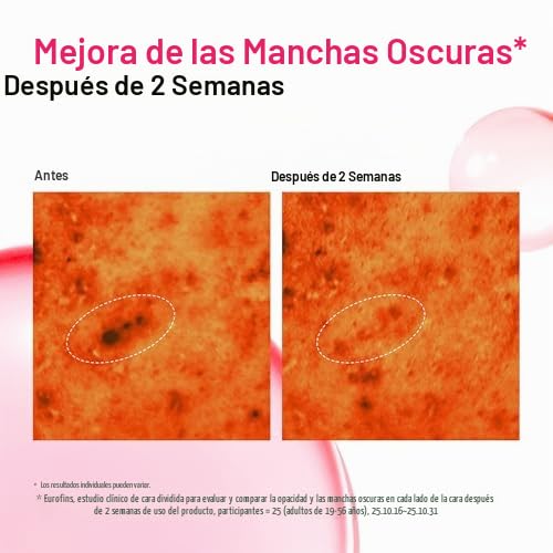 Anua Dúo corrector de manchas | Niacinamide 10 + TXA 4 Serum &amp;...