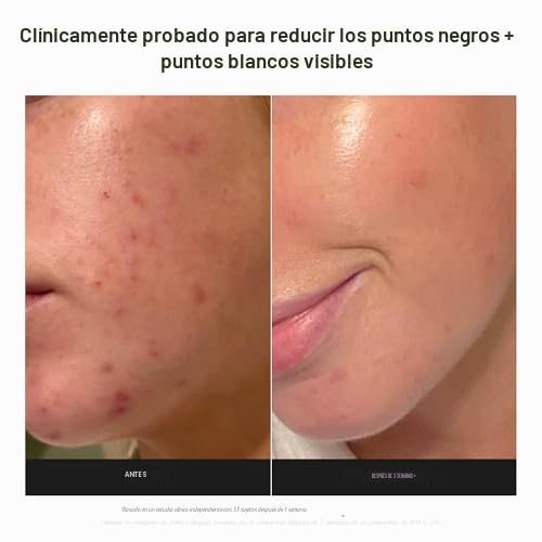 Paula's Choice SKIN PERFECTING 2% BHA Exfoliante líquido sin enjuag...