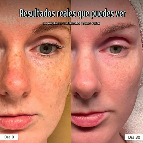 Solawave Máscara facial de terapia de luz roja y kit de suero para...