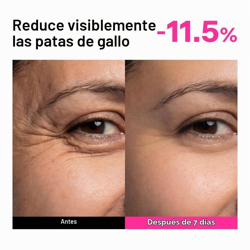 Colágeno, péptido y suero retiniano para líneas finas y arrugas (1....