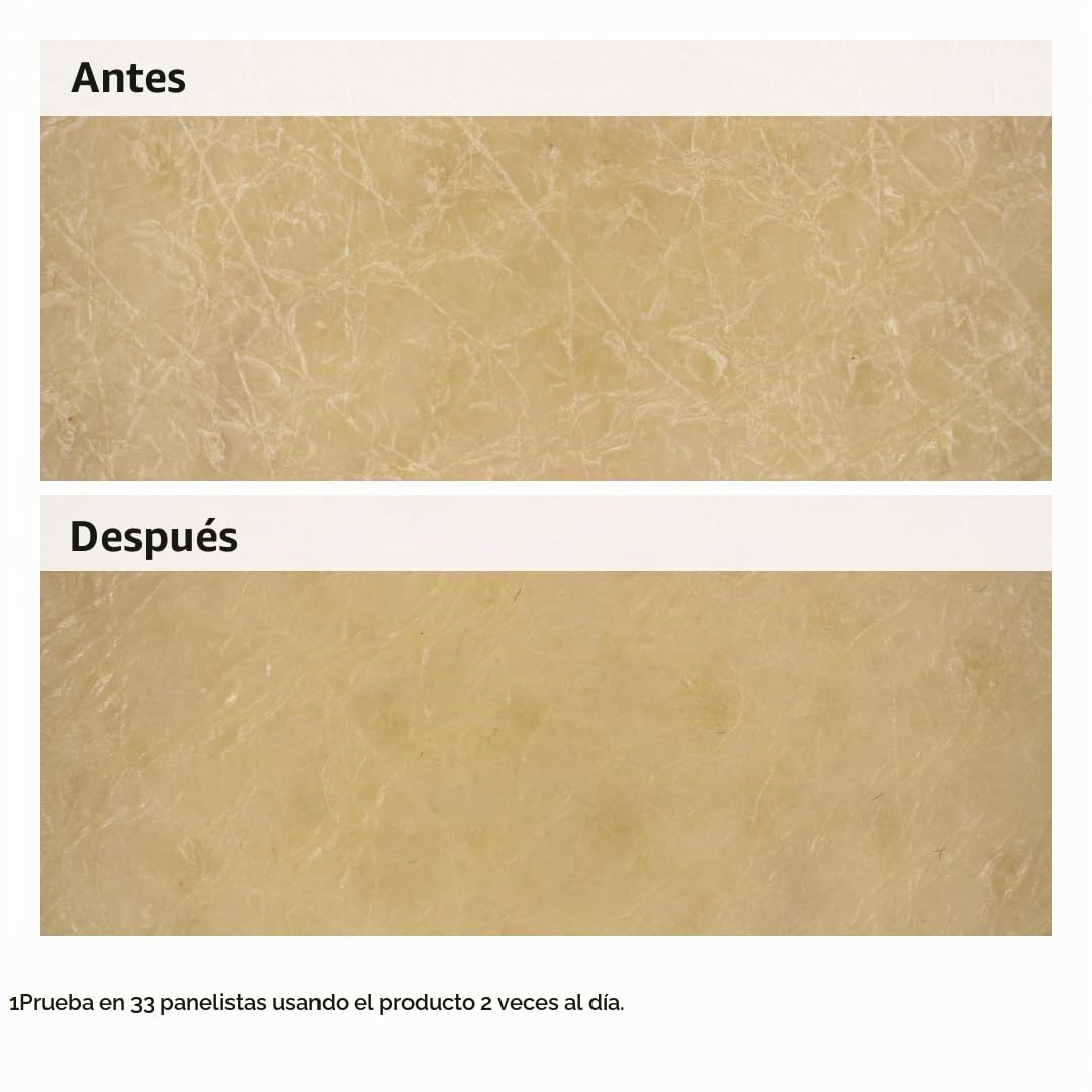 Los factores hidratantes naturales ordinarios + loción corporal de...