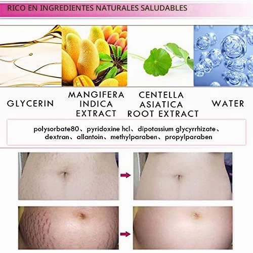 Crema para estrías y cicatrices de mango, crema para eliminar estrí...