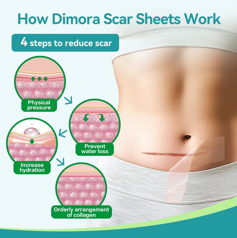 Dimora - Láminas de silicona de grado médico para cicatrices, cinta...