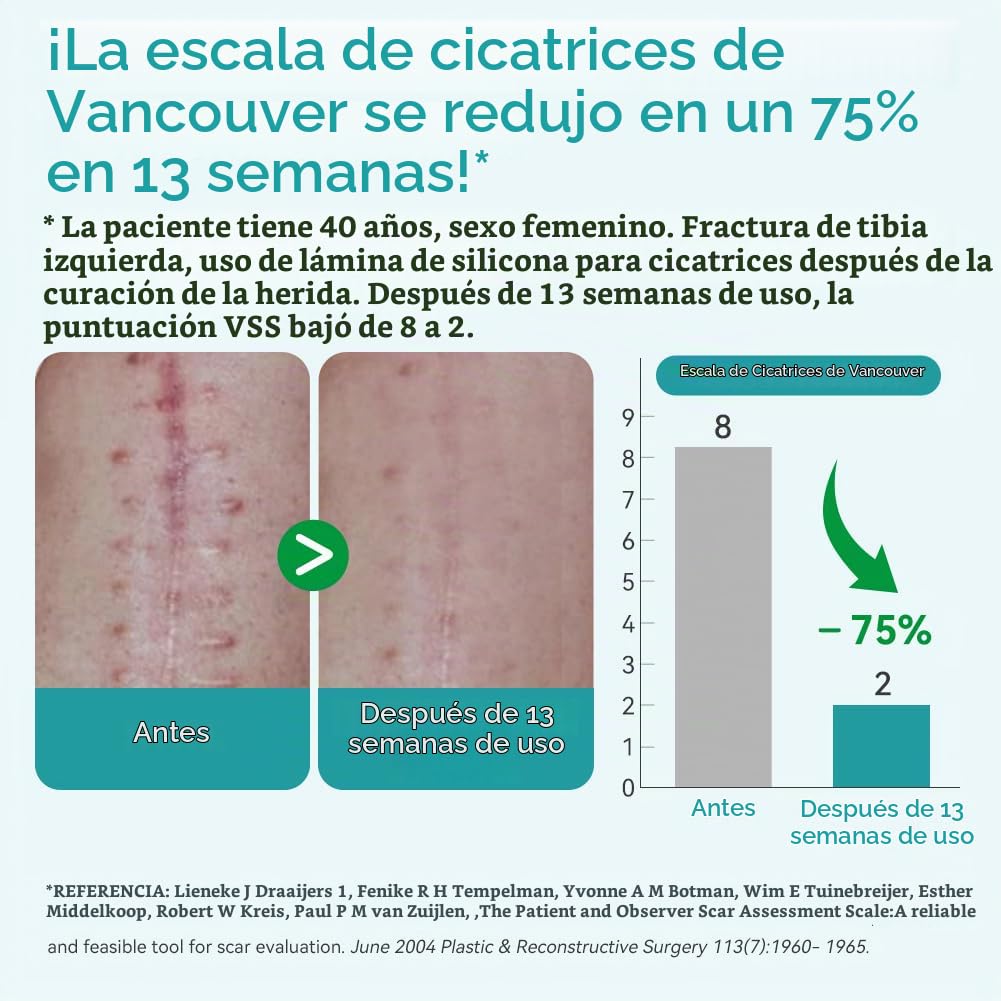 Dimora - Hojas de silicona para cicatrices de grado médico, rollo d...