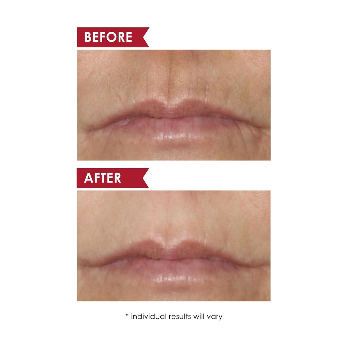 Dermelect Kit de retinol sin edad