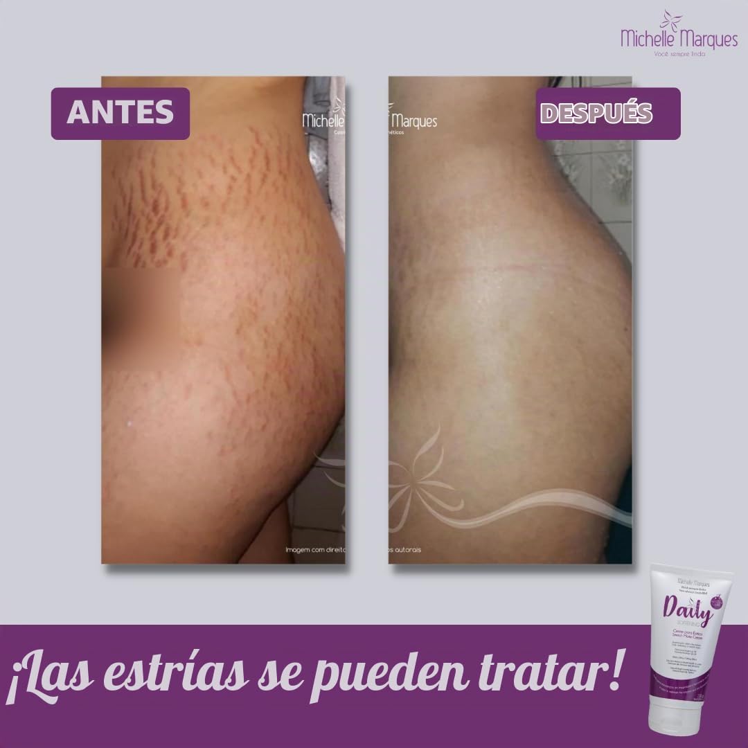 Michelle Marques Crema para estrías, suaviza y reduce la apariencia...