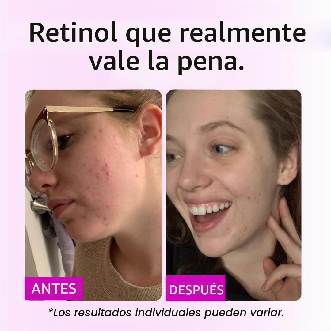 GLEOW - Suero de retinol para cara con ácido hialurónico y vitamina...