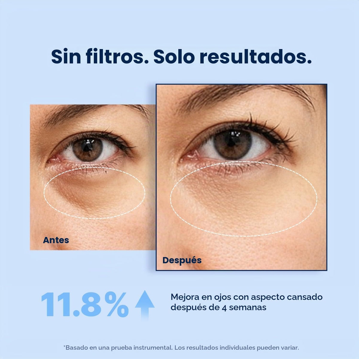 Enaskin Naturals Parches debajo de los ojos para ojos: 30 pares de...