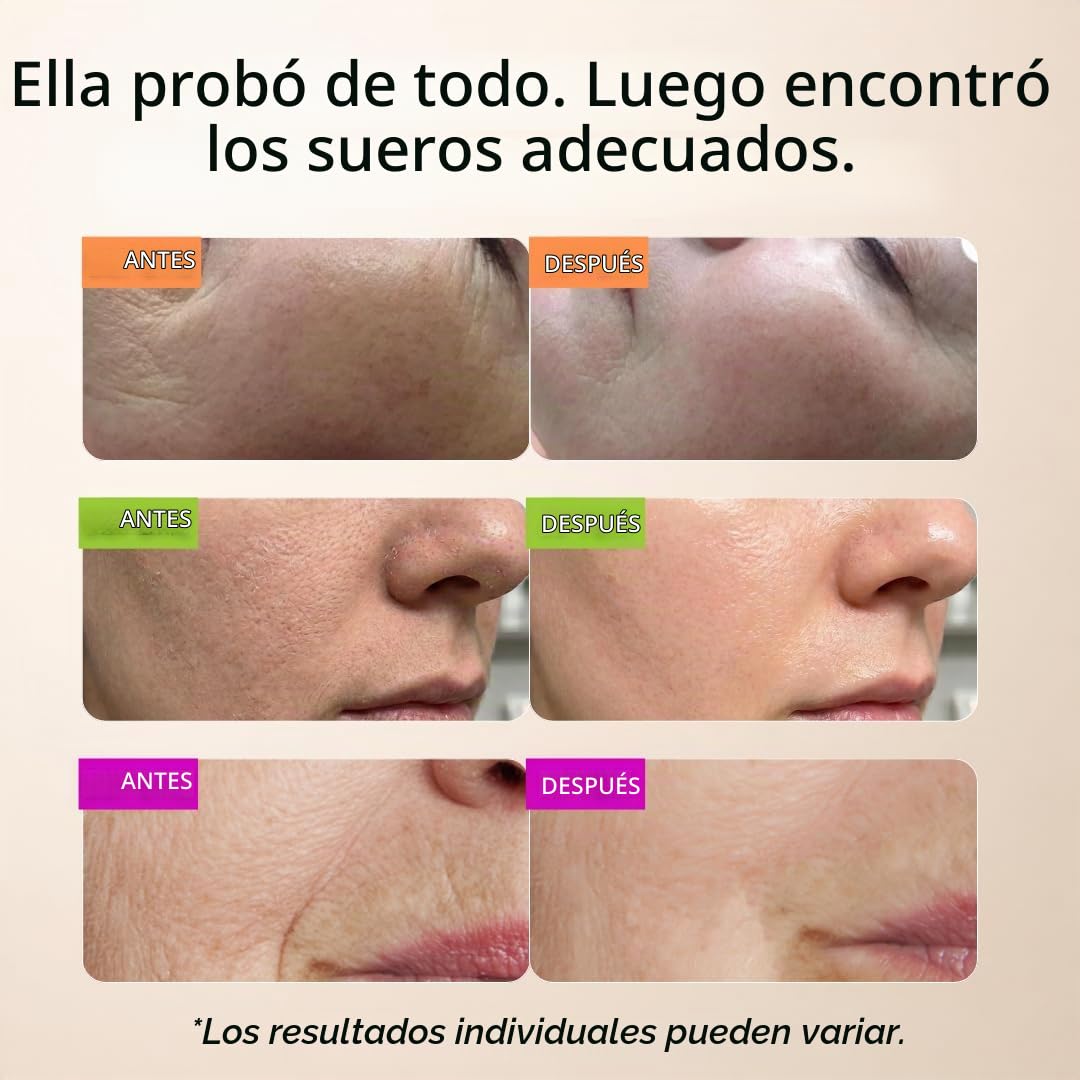 GLEOW - Set de cuidado de la piel: retinol, vitamina C y suero de á...