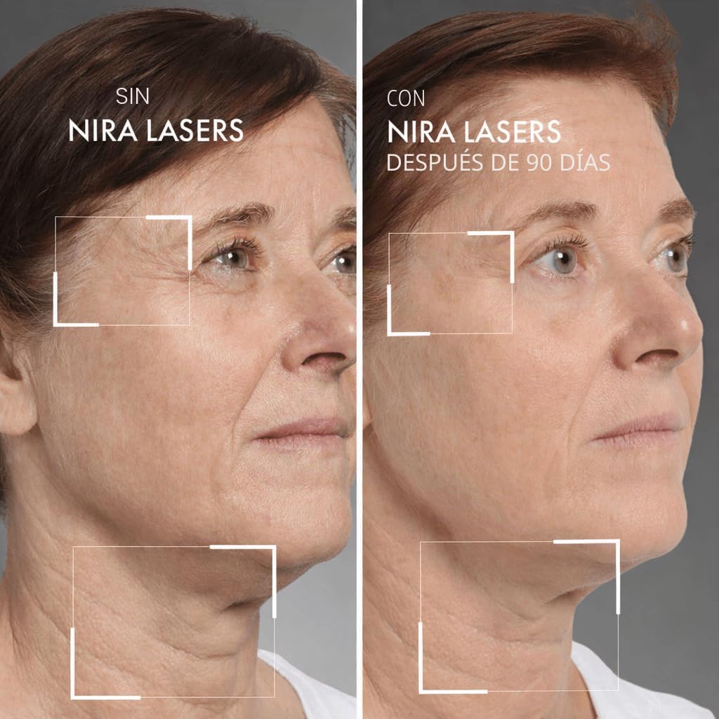 NIRA Terapia de luz láser de la FDA, antienvejecimiento, resultado...