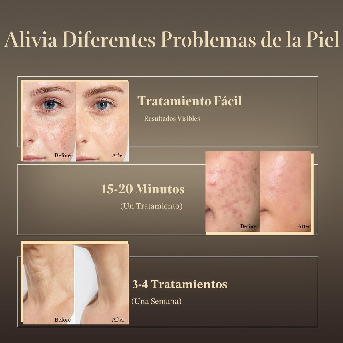 MEGELIN Máscara facial y cuello de terapia de luz roja, máscara fac...