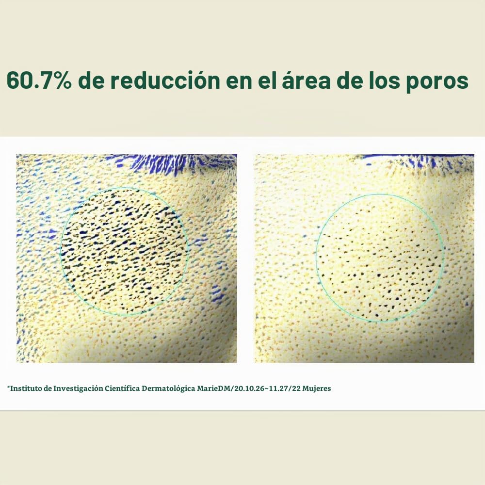 Pyunkang Yul PKY - Set de regalo calmante de prueba, tónico exfolia...