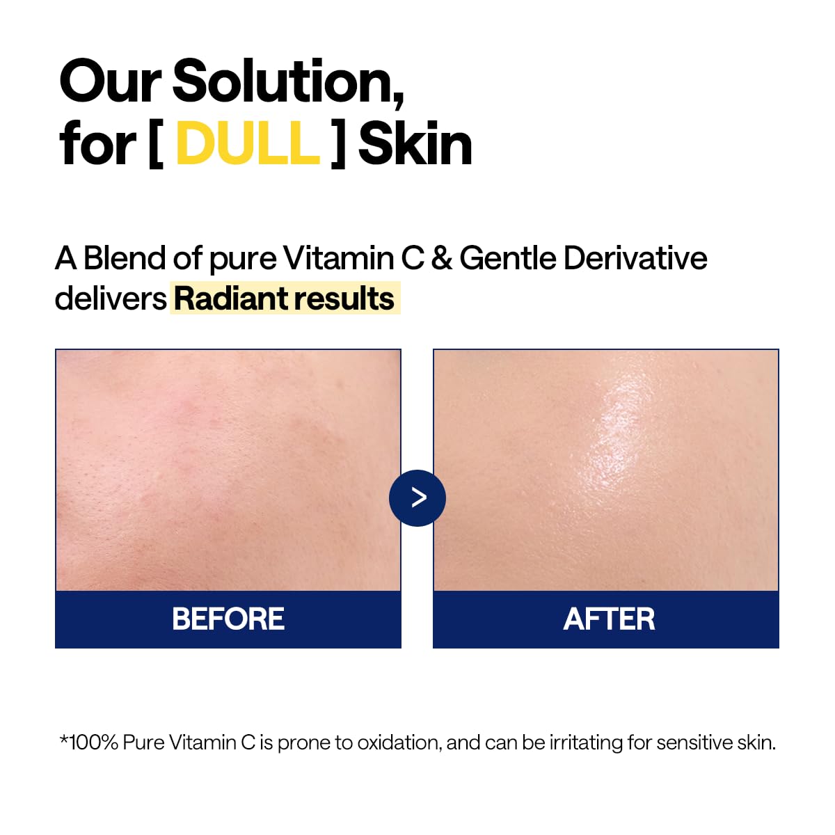 MEDIHEAL Suero Iluminador de Vitamina C (1.35 fl oz, 1 Paquete) - C...