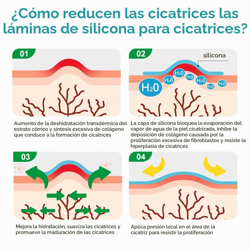 Dimora - Hojas de silicona para cicatrices de grado médico, rollo d...