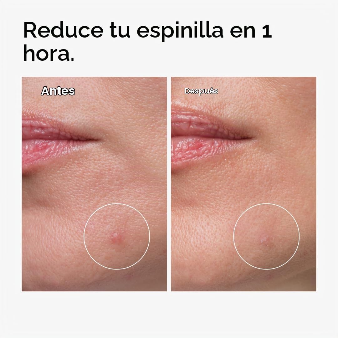 The Ordinary Oil Control Duo - Set para el cuidado de la piel, niac...