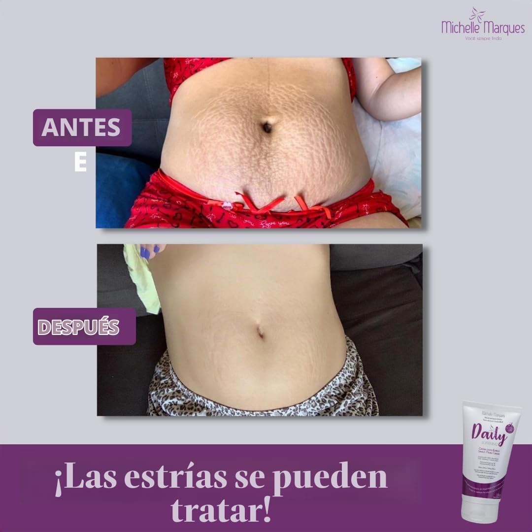 Michelle Marques Crema para estrías, suaviza y reduce la apariencia...