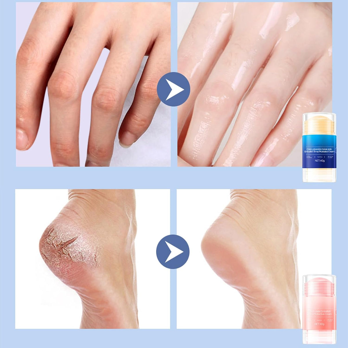 HJXUQIME Barra de prevención de grietas para pies, crema hidratante...