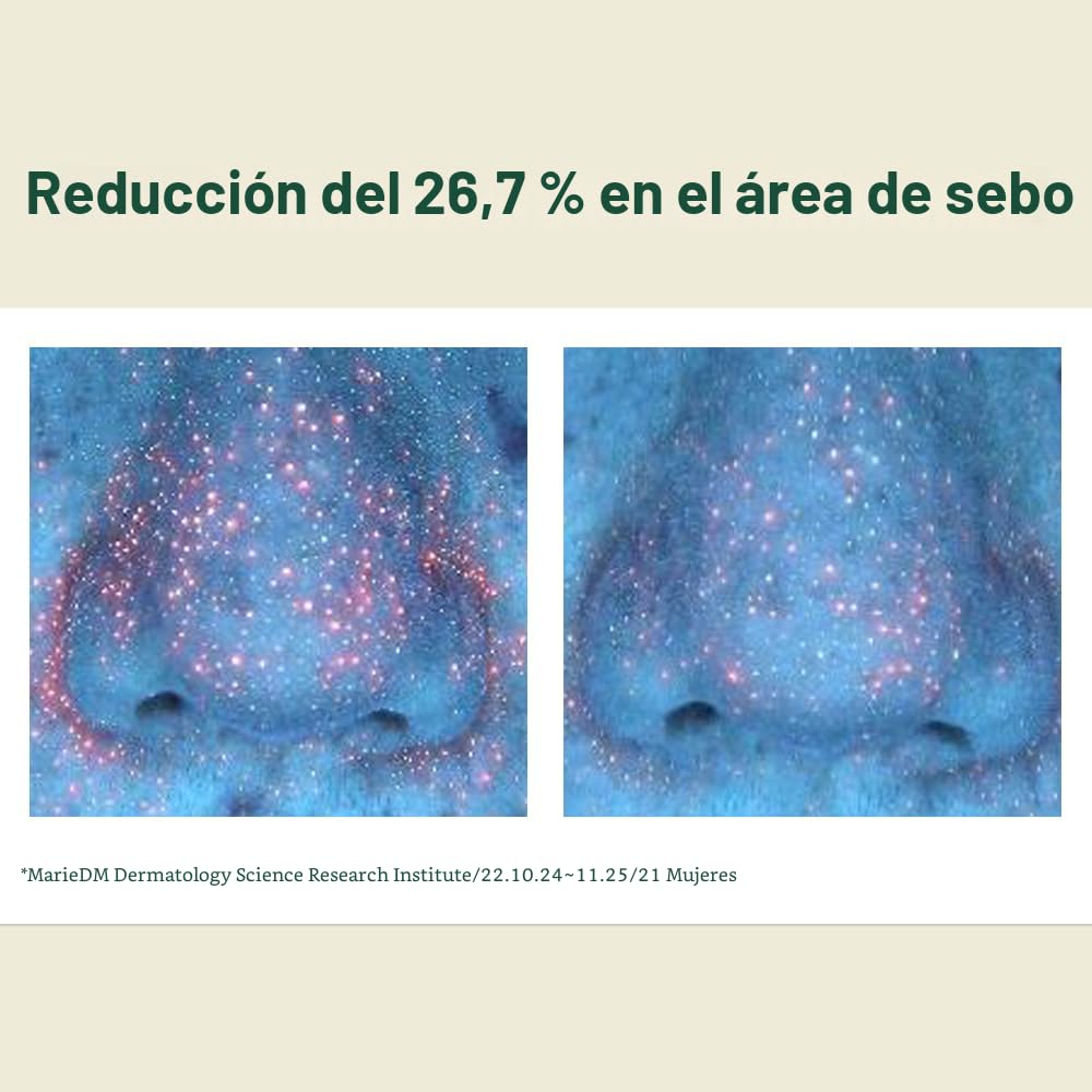 Pyunkang Yul Suero Calmante de Humectación para un Fuerte Poder Hid...