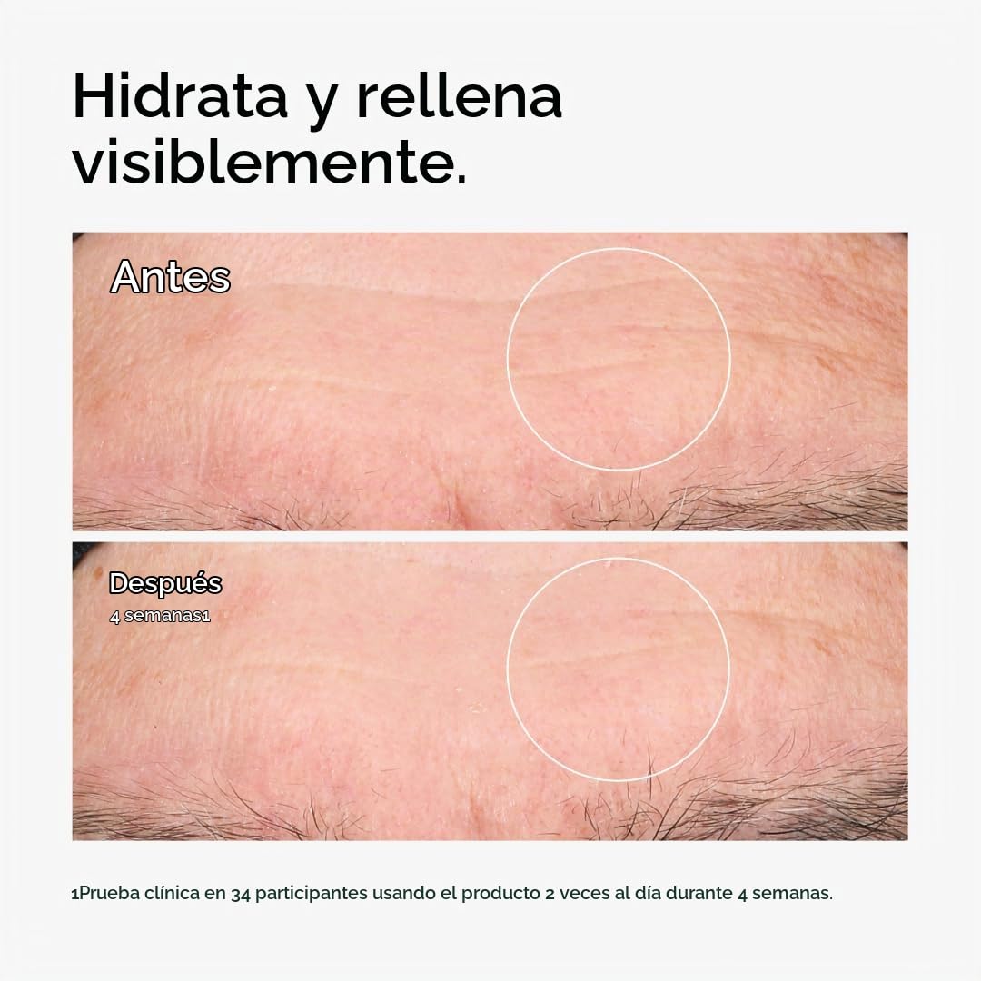 The Ordinary Ácido hialurónico 2% + B5 (con ceramidas), suero de hi...