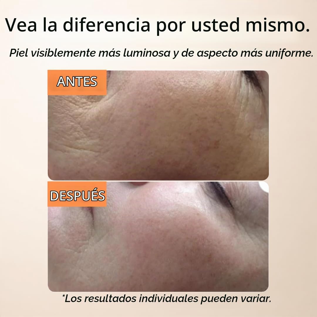 GLEOW - Suero de vitamina C para rostro con ácido hialurónico y vit...