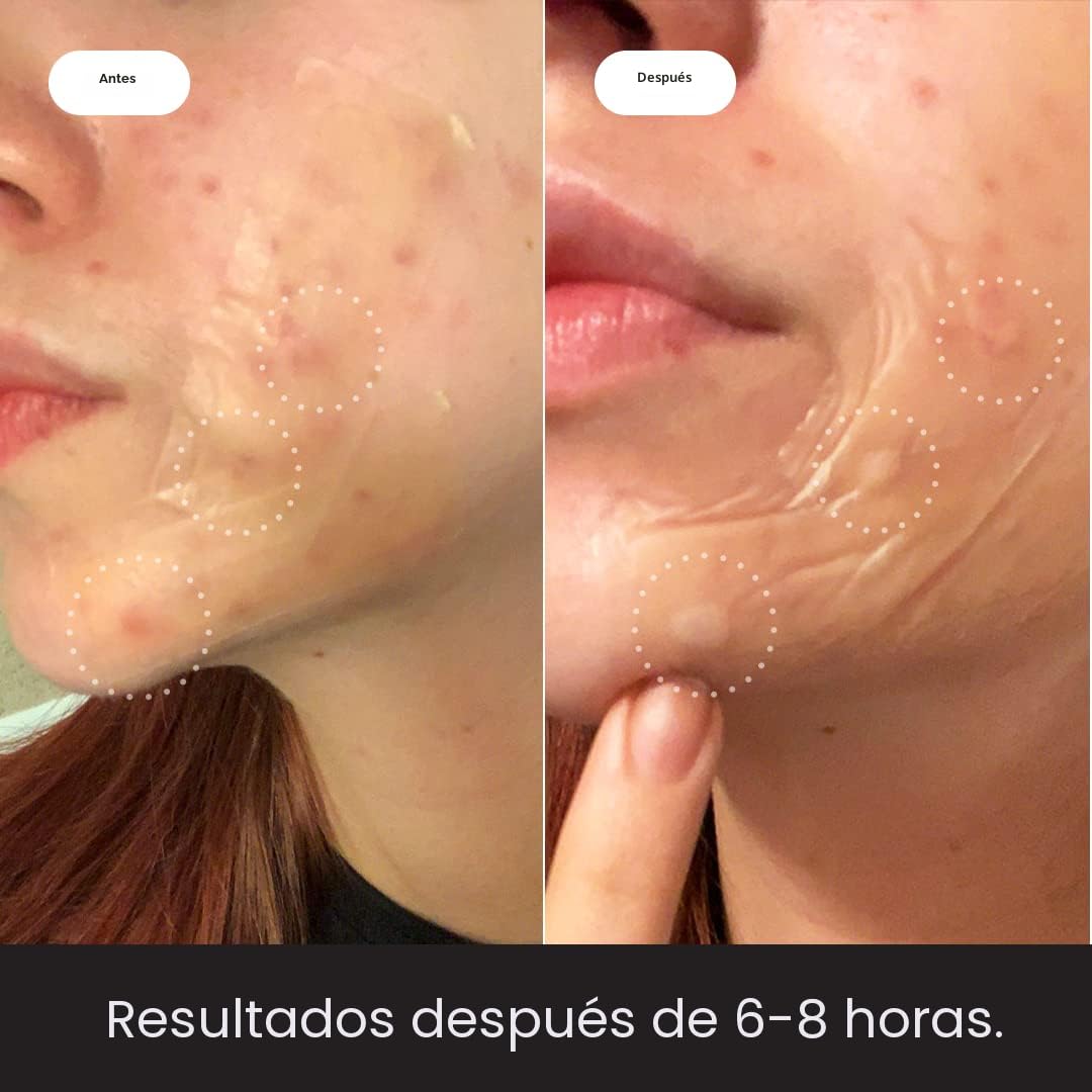 Hero Cosmetics Mighty Patch™ XL Patch Duo - Parches hidrocoloides X...