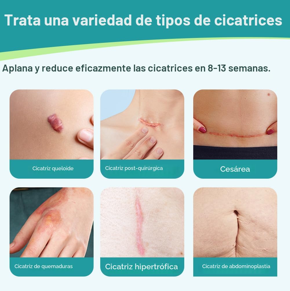 Dimora - Láminas de silicona de grado médico para cicatrices, cinta...