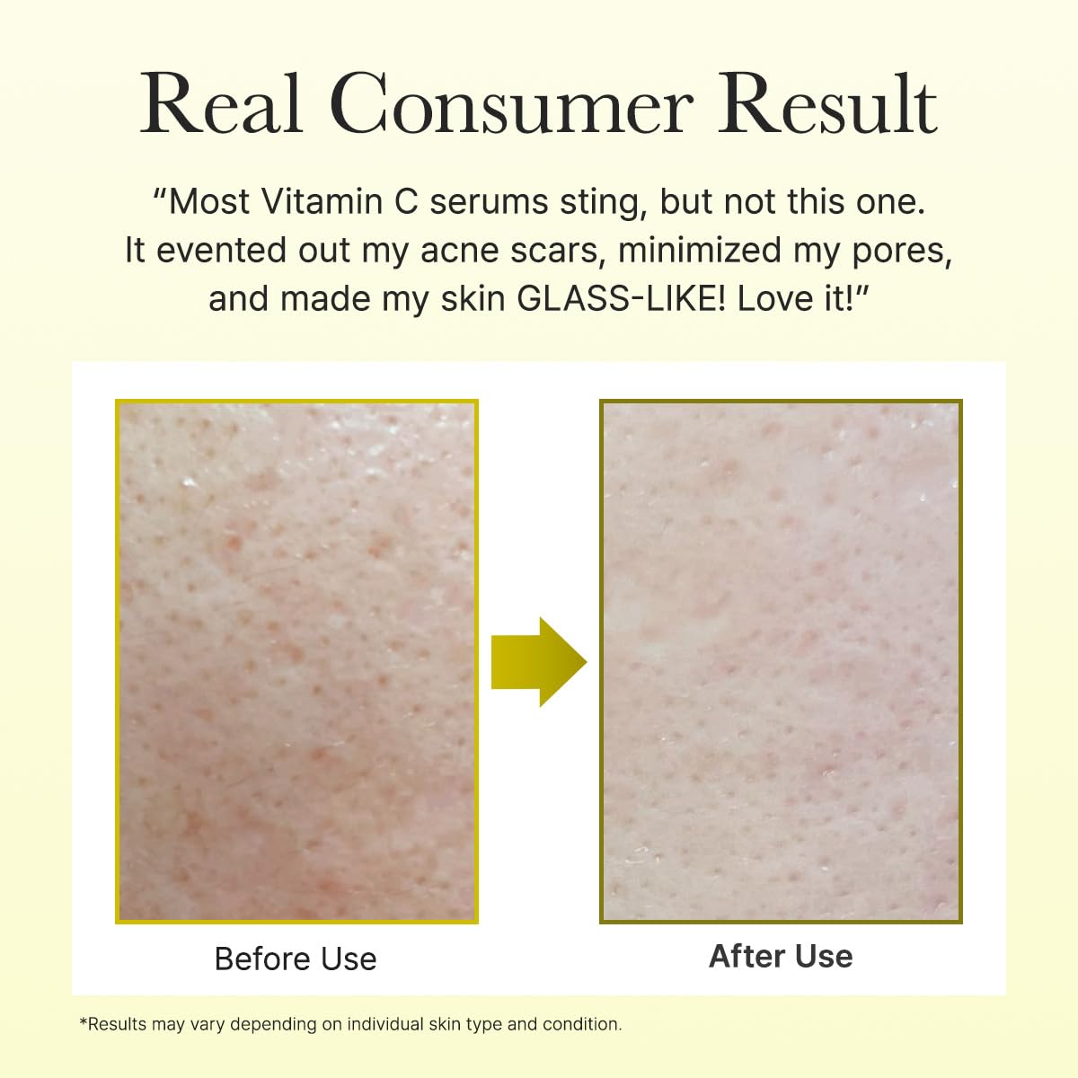 Arencia Suero potenciador de vitamina C con glutatión, niacinamida...