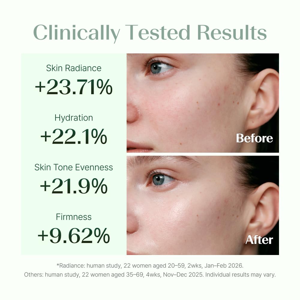Suero facial con niacinamida, retinol y ácido hialurónico, piel de...