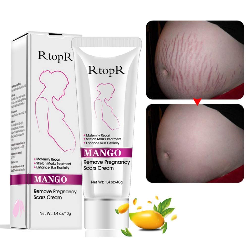 Crema para estrías y cicatrices de mango, crema para eliminar estrí...