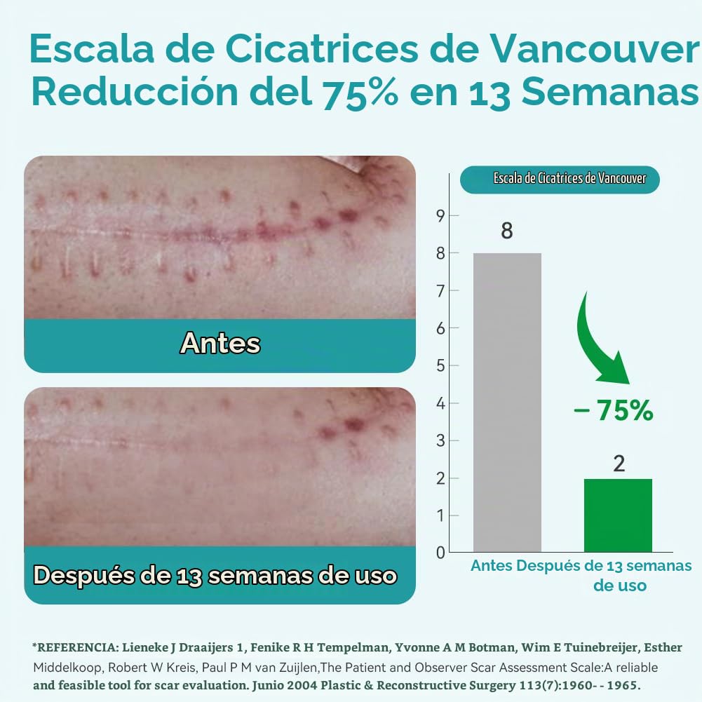 Dimora - Láminas de silicona de grado médico para cicatrices, cinta...