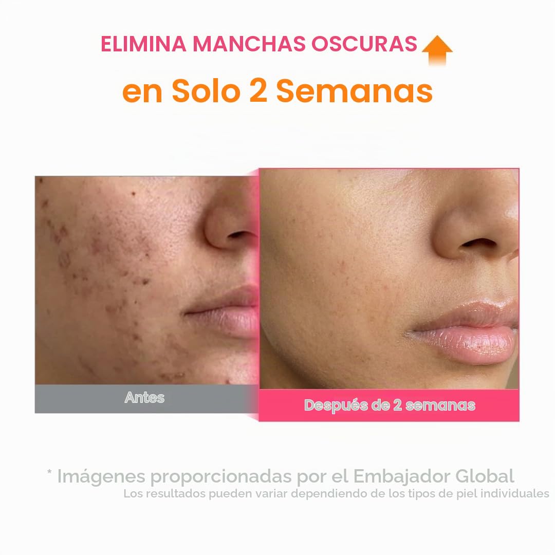 PURITO TXA 6% Niacinamida 10% Suero para pieles sensibles, 1.01 fl....