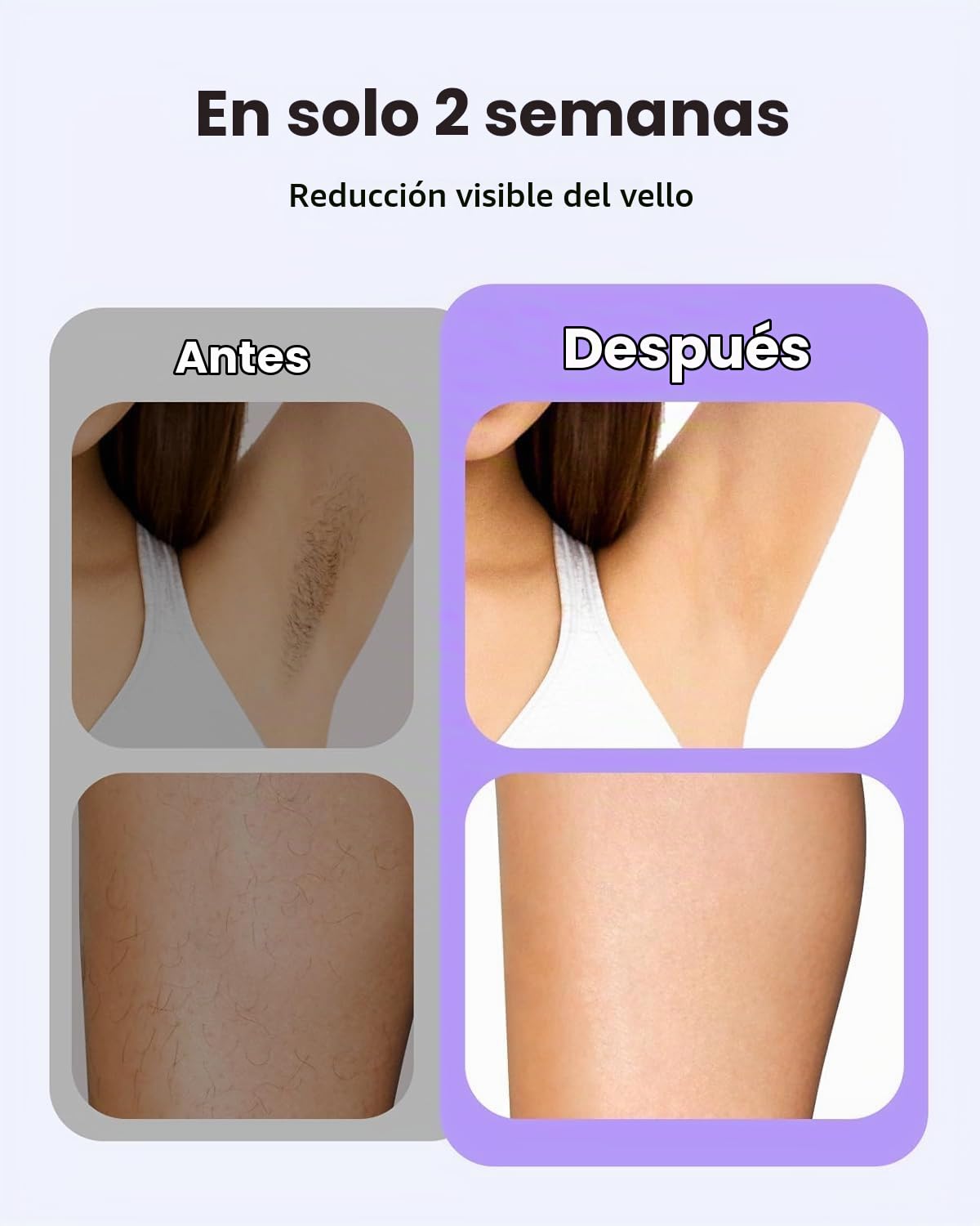 LYSMOSKI Depilación láser para mujeres y hombres, dispositivo de de...