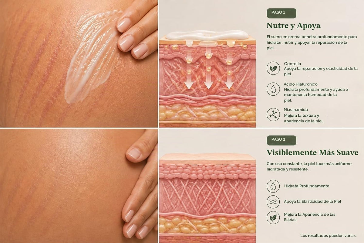StriaeMend Crema de estrías para el embarazo, suero ligero 5.07 onz...