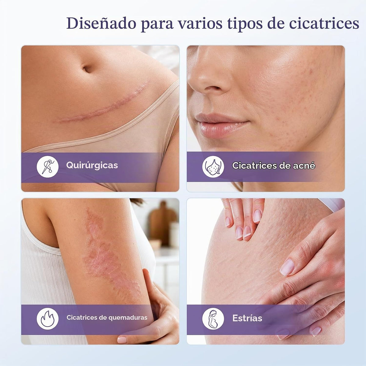 Gel de cicatriz de silicona de grado médico para cicatrices quirúrg...