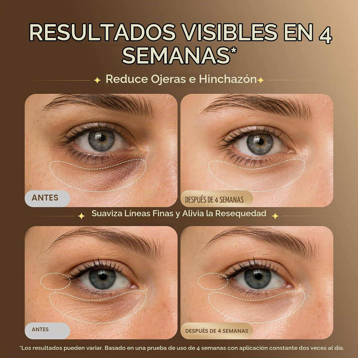 Suero debajo de los ojos para ojeras e hinchazón: suero de ojos con...