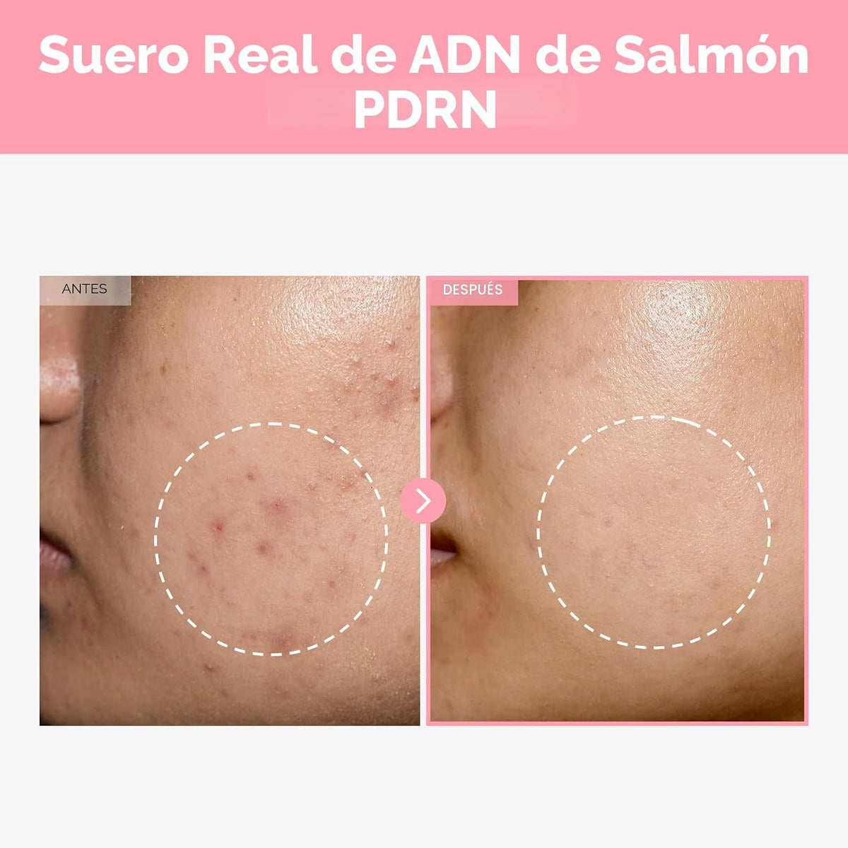TOSOWOONG Ultimate Clear Glass Skin Serum Duo: Péptido rosa 12 PDRN...