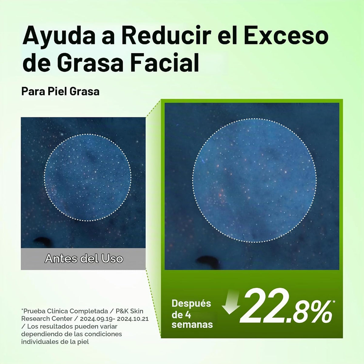 Anua Azelaic Acid 10 Hyaluron Suero calmante para el enrojecimiento...