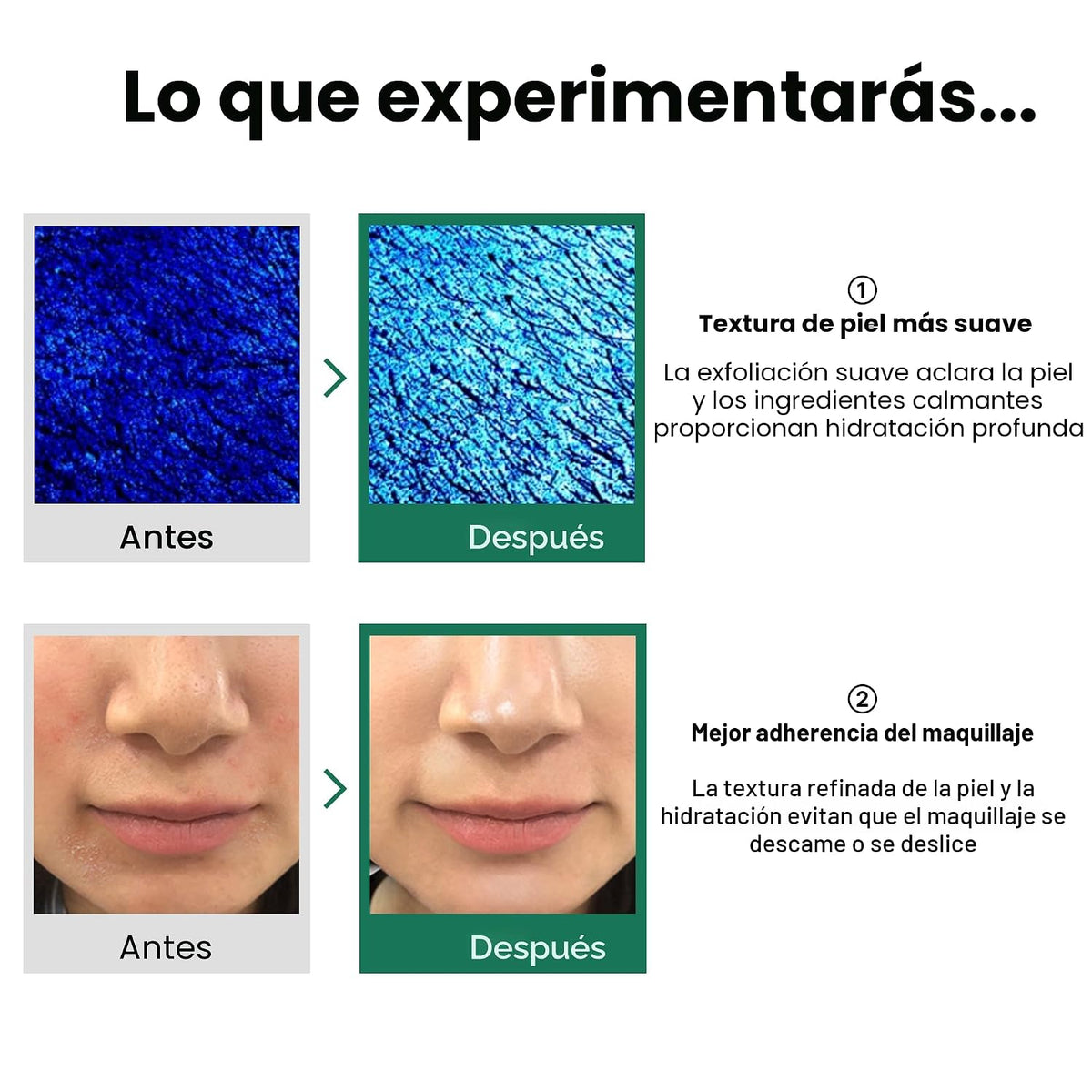SOME BY MI AHA BHA PHA PHA 30 Days Miracle Toner - Paquete de 2 - T...