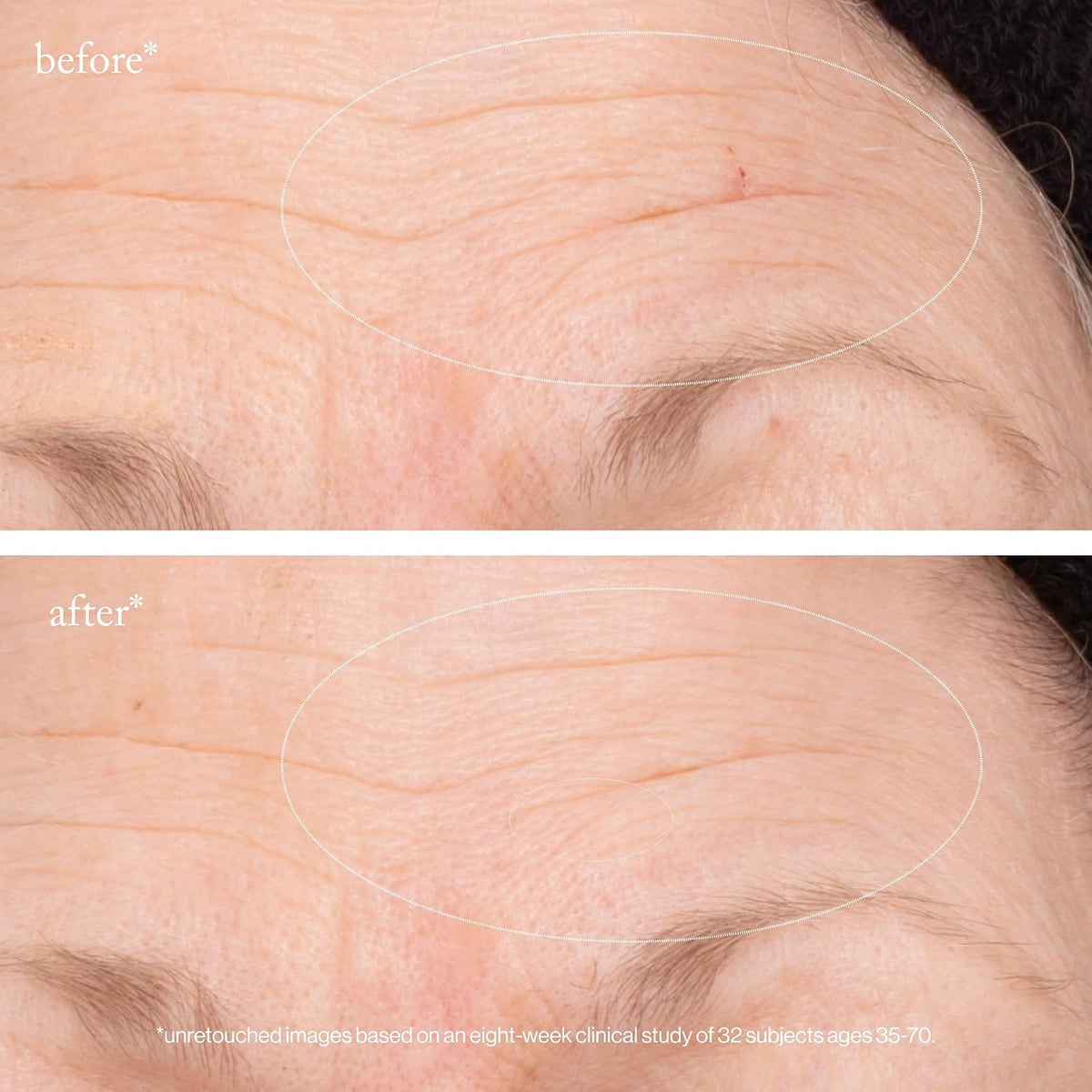 goop Beauty 3x Suero regenerador de retinol | Suero facial para red...