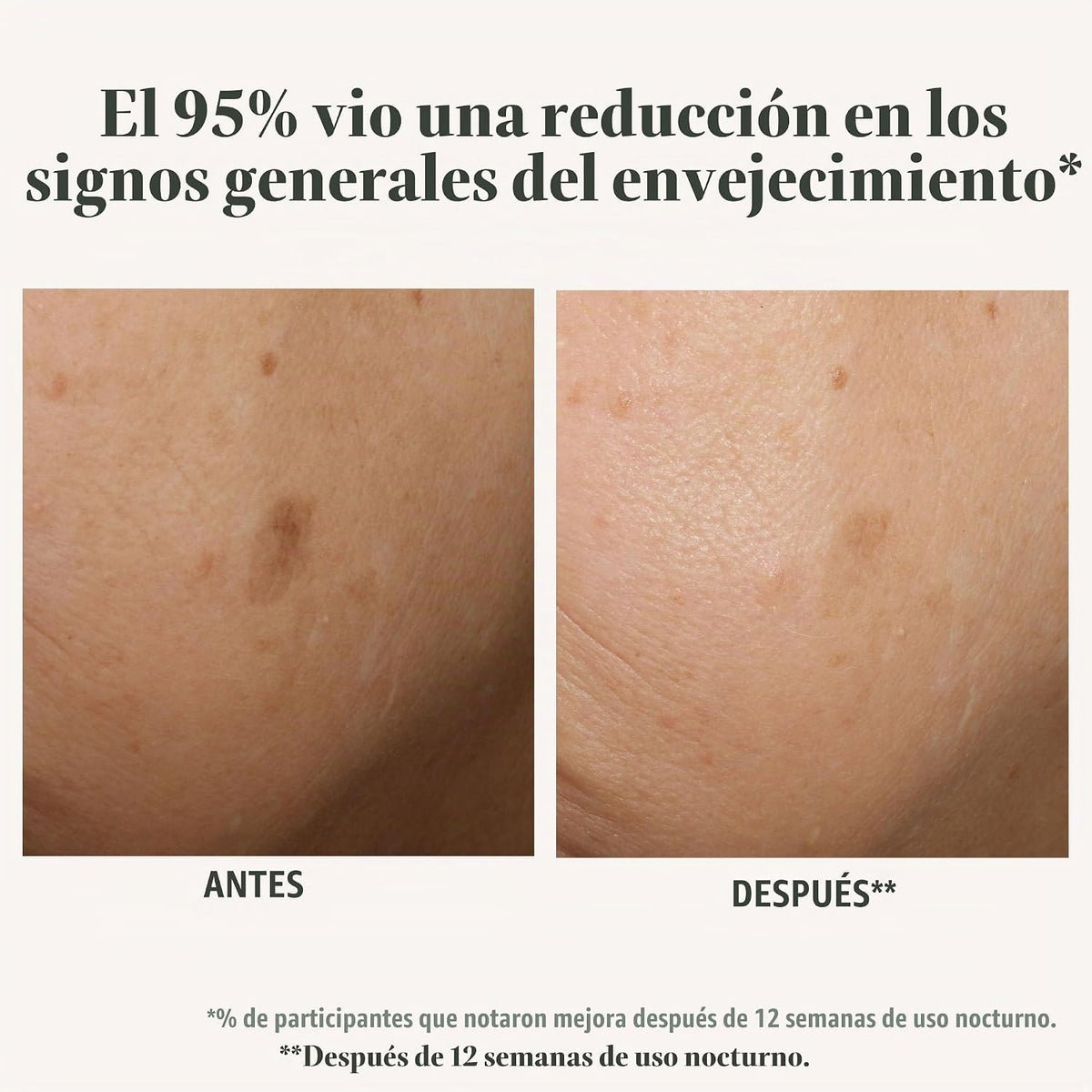 EXUVIANCE AGE REVERSE+ Advanced Renewal Retinol Overnight Serum Ant...