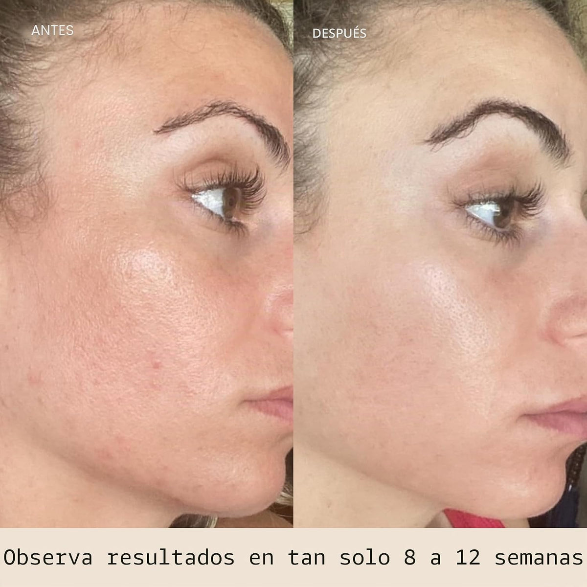 Barefaced Liquid Gold - Suero de 15% vitamina C con ácido hialuróni...