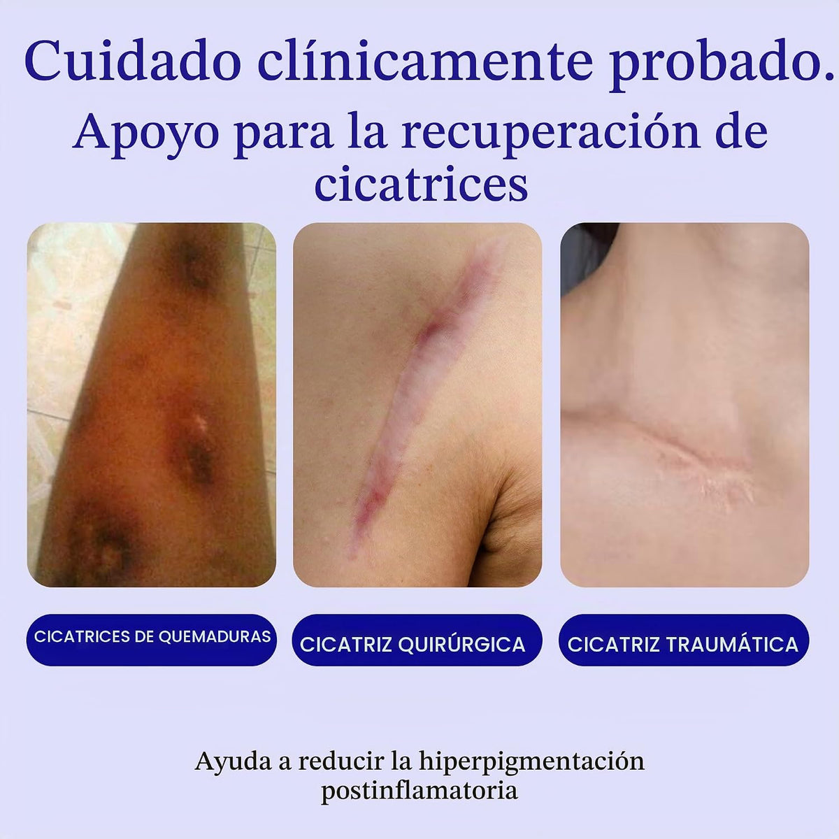 Rejuvaskin Esthetique Crema para cicatrices con silicona, 23 ingred...