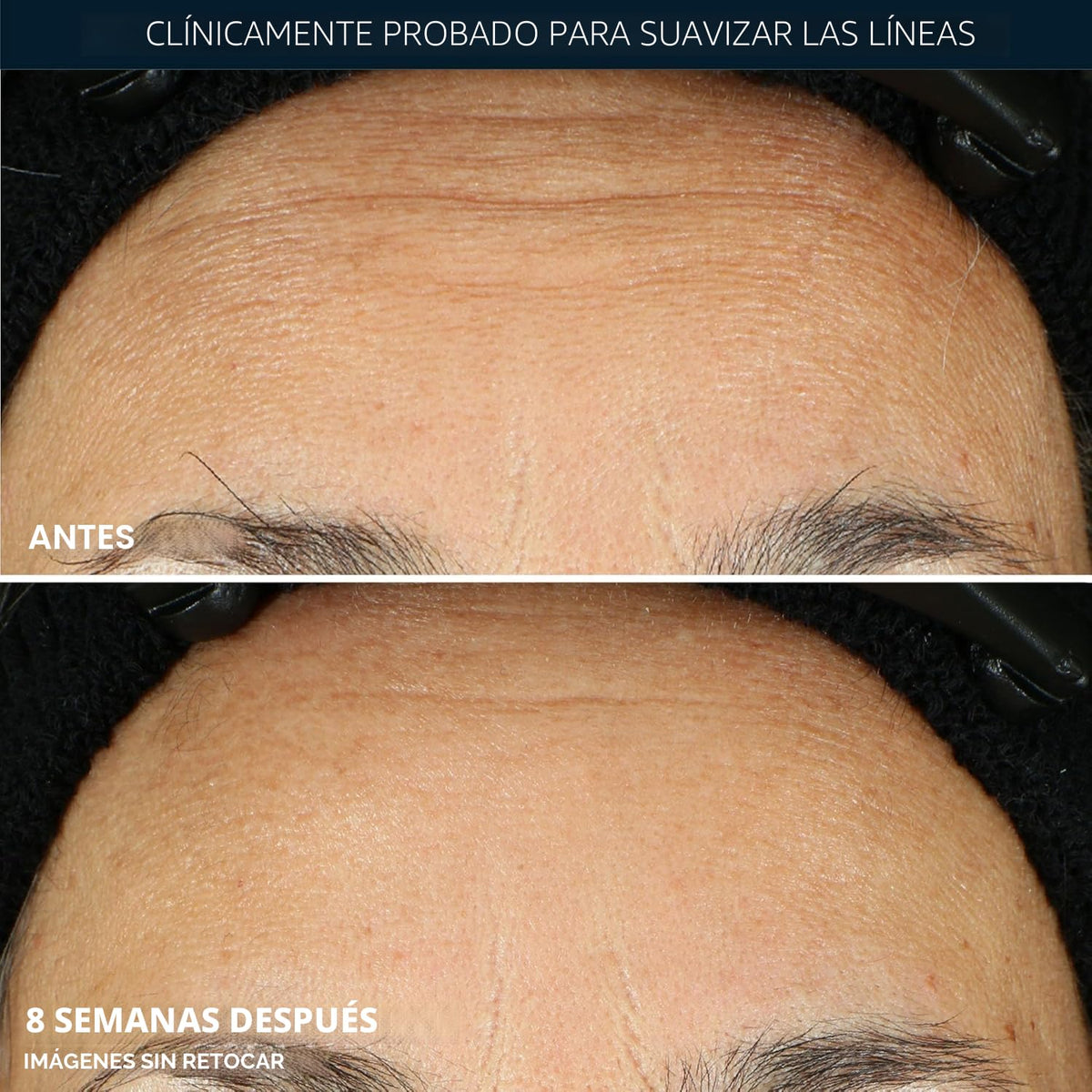 RoC Retinol Correxion Cápsulas de suero nocturno antienvejecimiento...