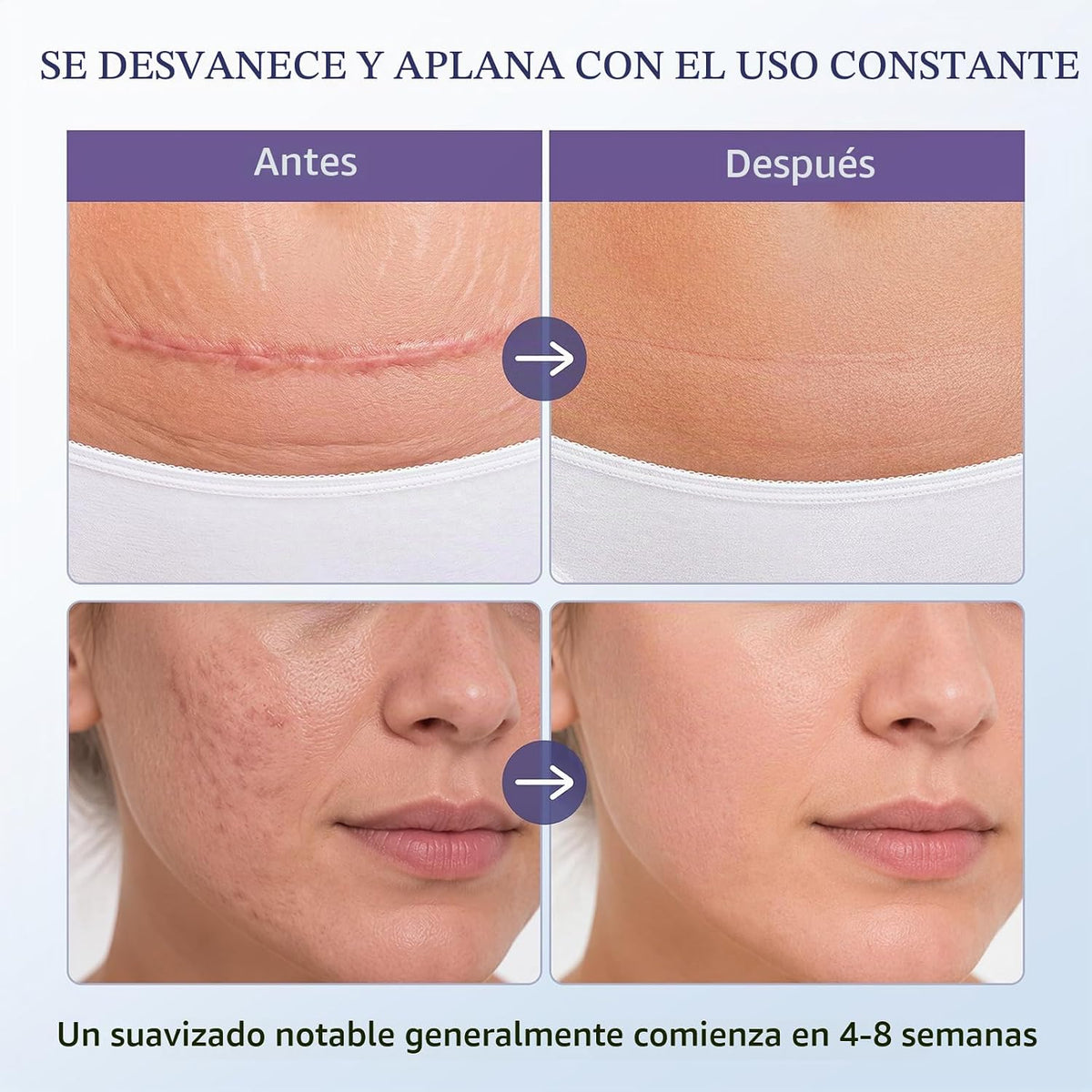 Gel de cicatriz de silicona de grado médico para cicatrices quirúrg...