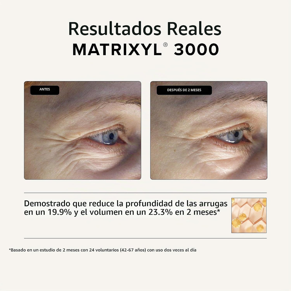Suero peptídico Asterwood Matrixyl 3000 y Argireline con ácido hial...