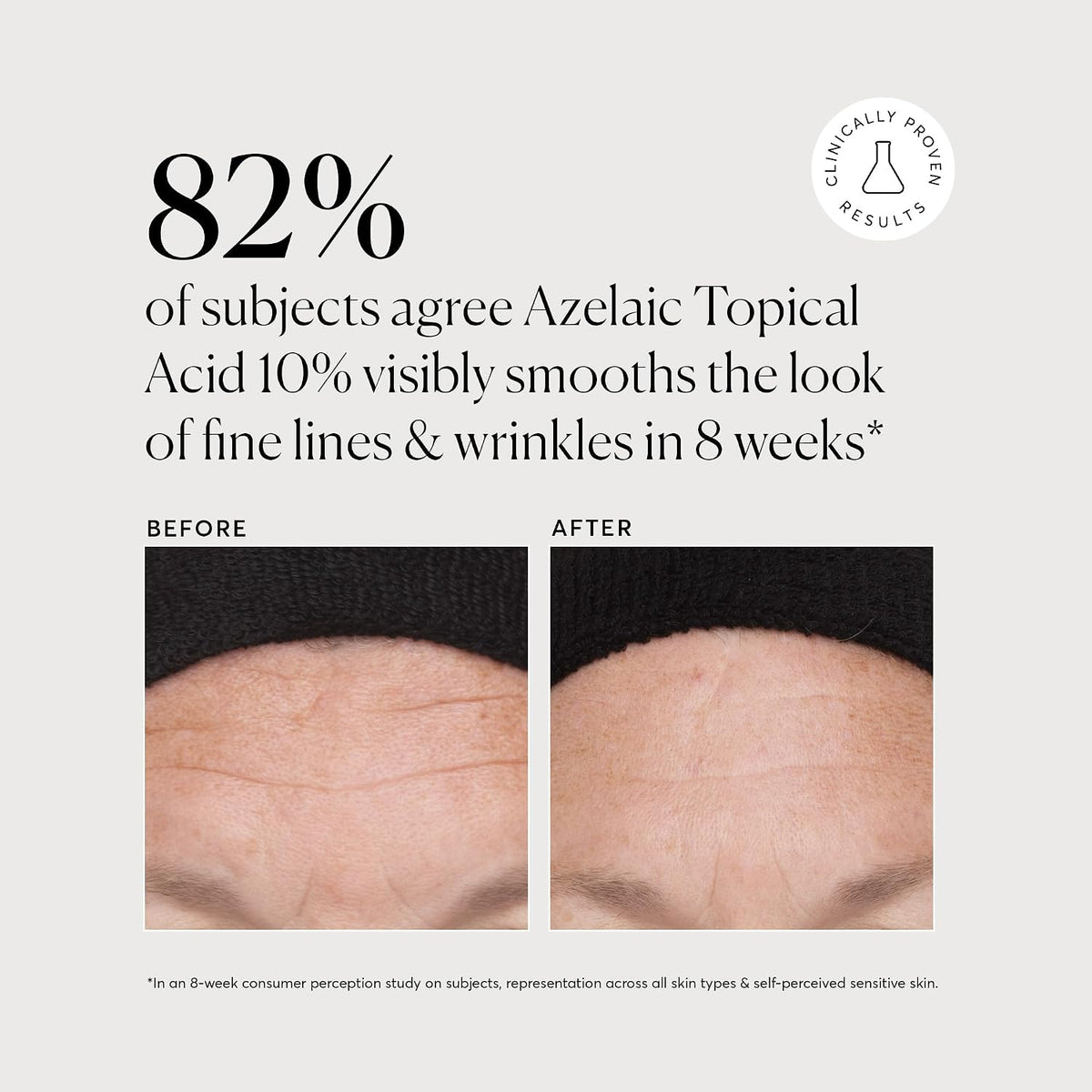 Naturium Azelaic Topical Acid 10% Jumbo, tratamiento de belleza par...