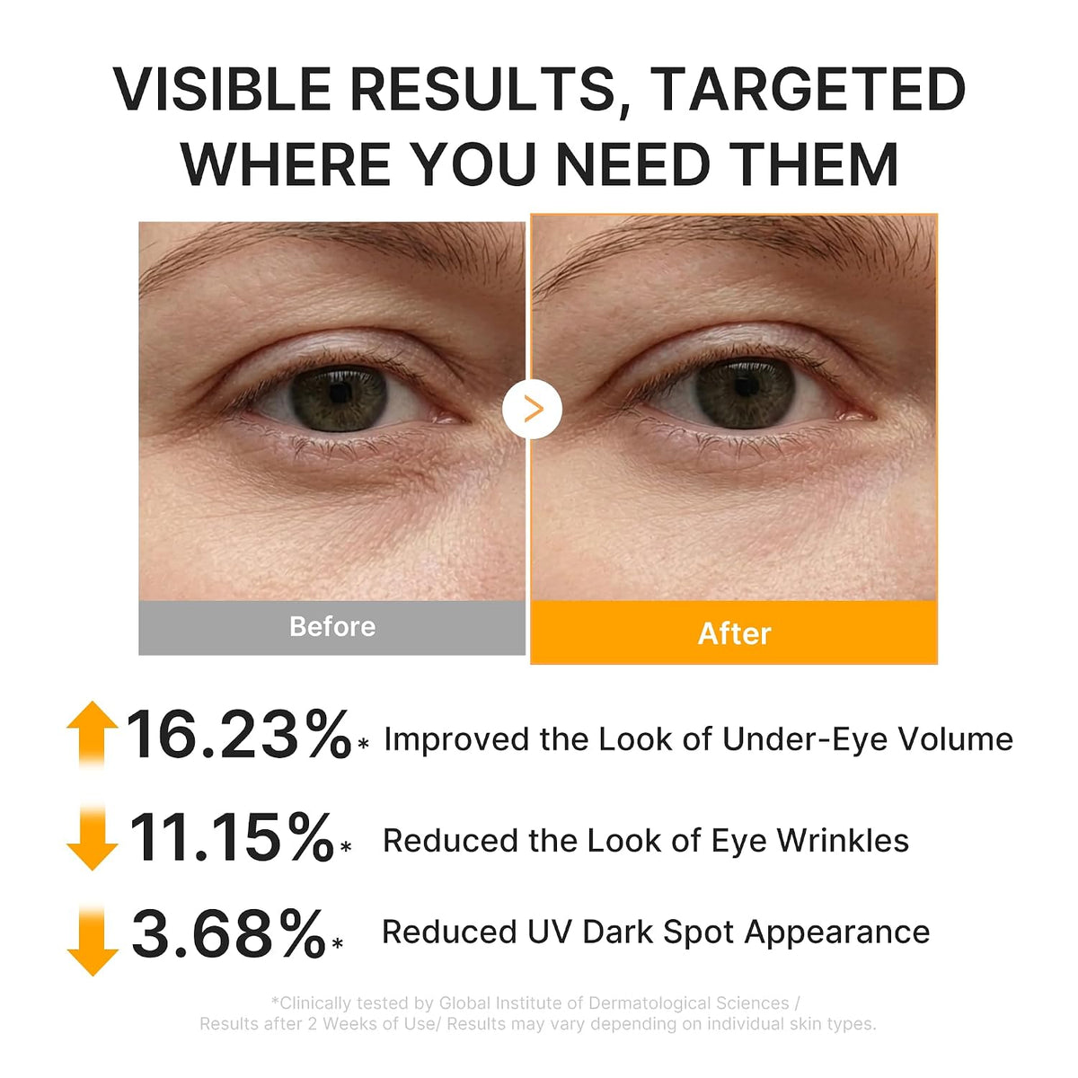 medicube Parches de hidrogel para ojos y cara con cúrcuma de ácido...