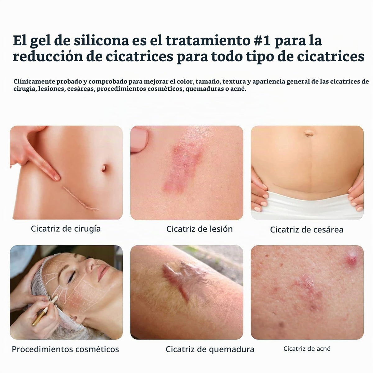 Gel 100% silicona para cicatrices, paquete de 3 \u2013 3 x 1.06oz c...