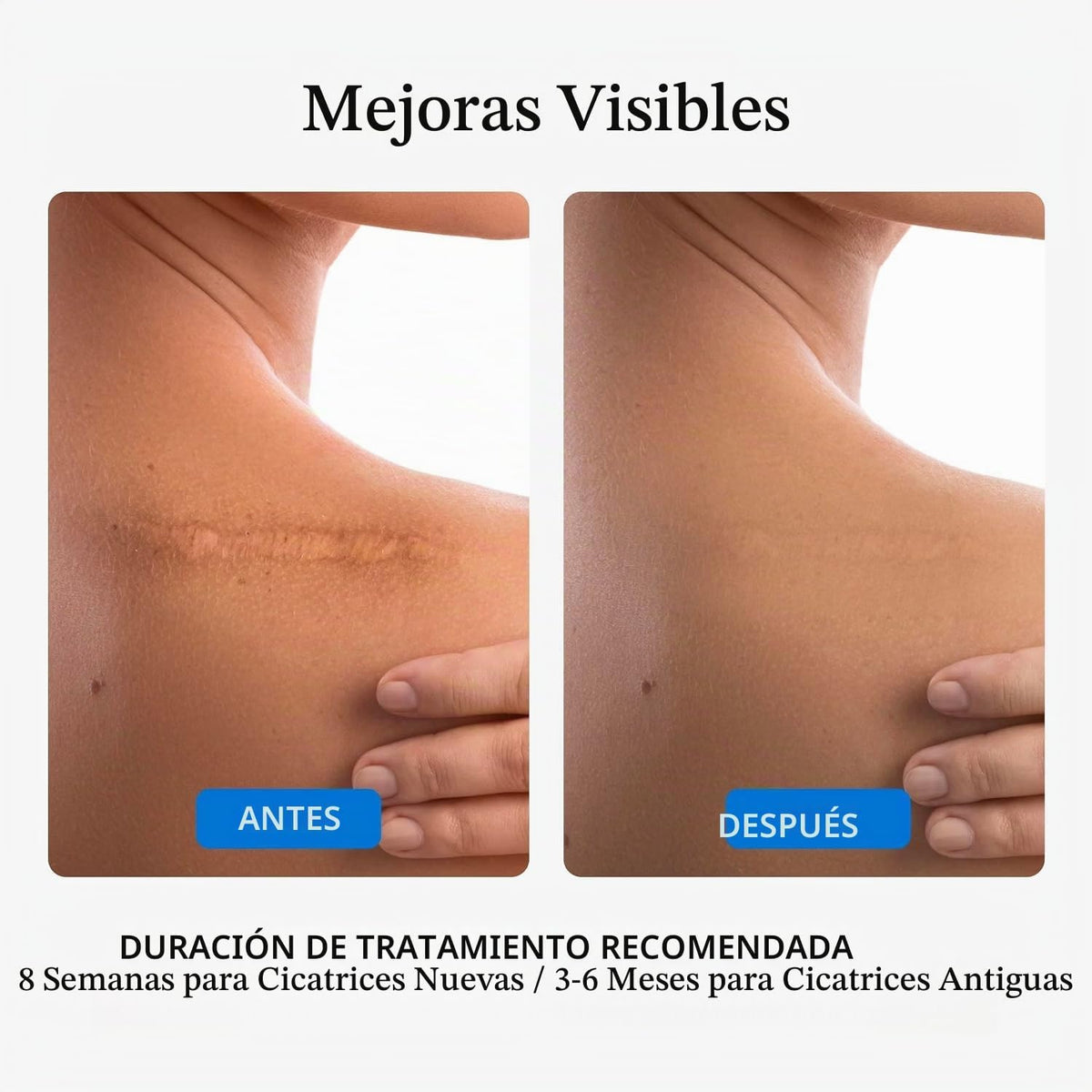 NUVADERMIS Gel de cicatrices \u2013 Crema para cicatrices quirúrgic...